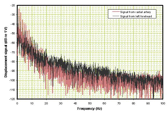Frequency domain comparison of traces